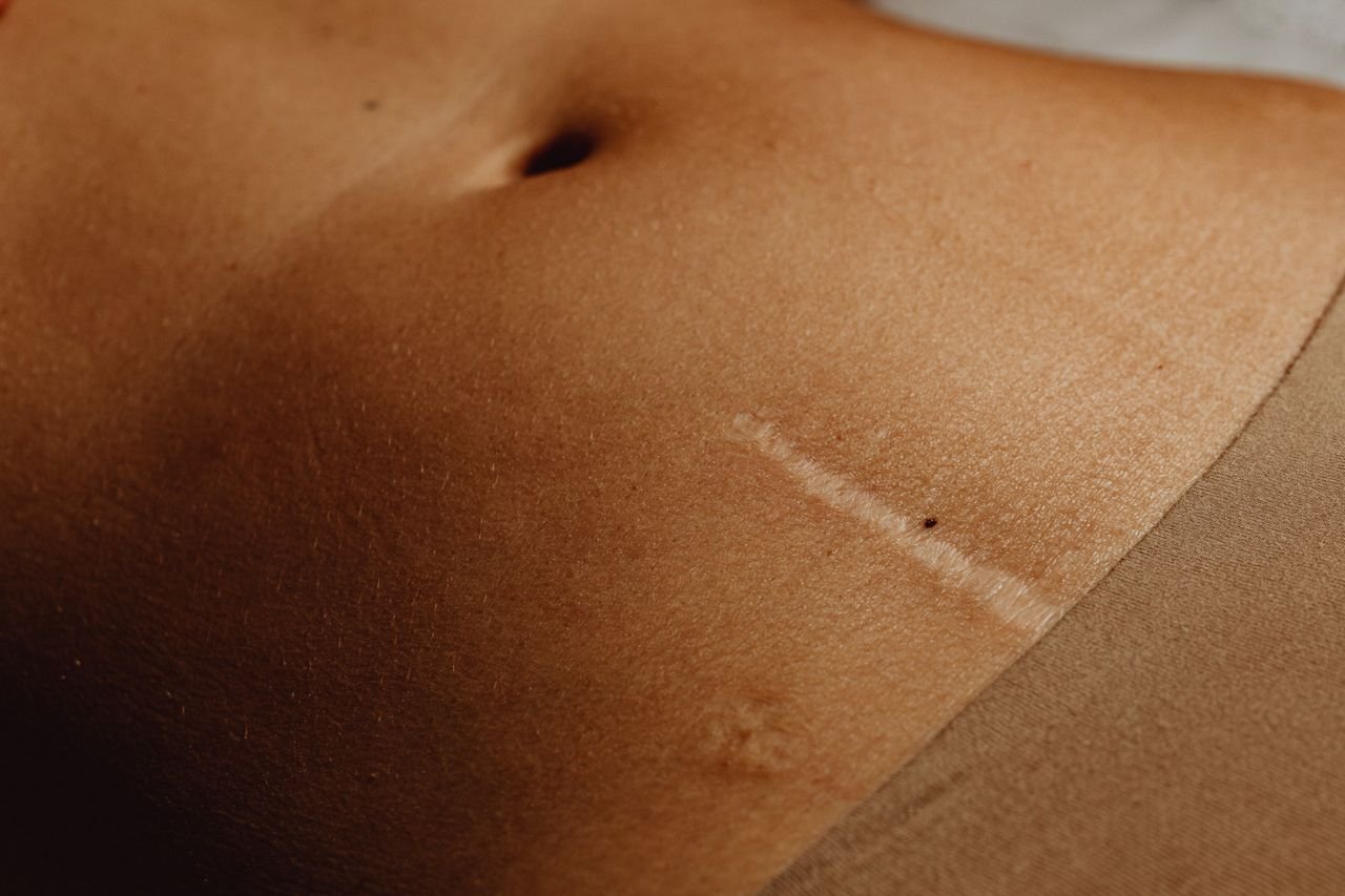 Modelos de cintas abdominais: 9 recomendações de escolha!